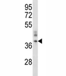 ORAI1 Antibody (CRACM1) - image 1