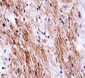 Ddr2 Antibody - image 1