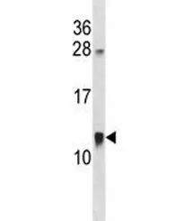 ACBD7 Antibody - image 1