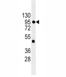 E Cadherin Antibody (CDH1) - image 1