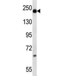 Alpha-2-macroglobulin Antibody - image 1