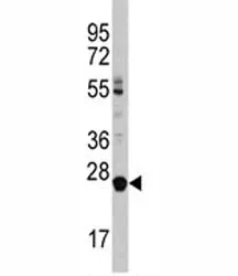 LIN28B Antibody - image 1
