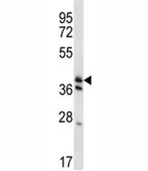 KLF2 Antibody - image 1