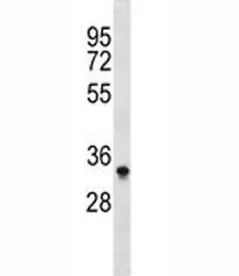 Aurora-B Antibody (Aurkb) - image 1