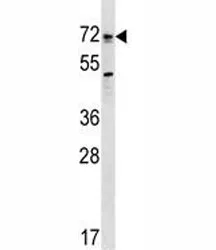 Bmpr1a Antibody (Alk3) - image 1