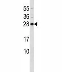CD79b Antibody - image 1
