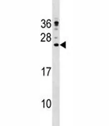 CAMP Antibody - image 1