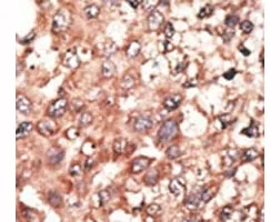 BMP5 Antibody - image 1