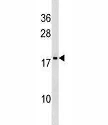 DR1 Antibody (Down-regulator of transcription 1) - image 1