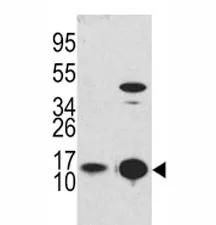 LC3B Antibody (MAP1LC3B) - image 1