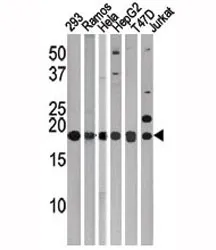 LC3C Antibody (MAP1LC3C) - image 1