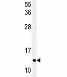 LC3C Antibody (MAP1LC3C) - image 1