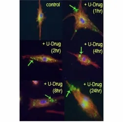 LC3B Antibody (MAP1LC3B) - image 1