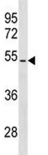 PTEN Antibody - image 1