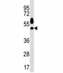 Sgk1 Antibody - image 1