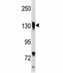 Integrin beta 1 Antibody - image 1