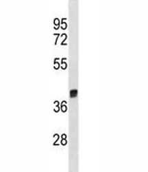 Arg1 Antibody - image 1