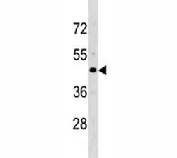 CCR5 Antibody - image 1