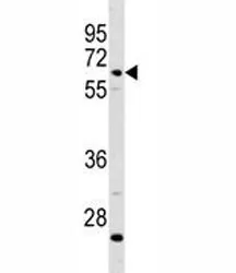 Complement C8 beta Antibody (C8B) - image 1