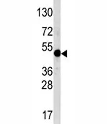 AP2 alpha Antibody (TFAP2A) - image 1