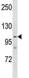 PARP 1 Antibody - image 1