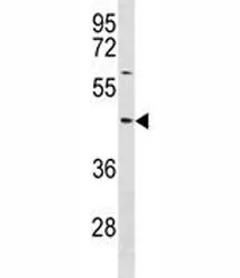 TXNIP Antibody - image 1