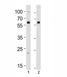 BMPR1A Antibody (ALK3) - image 1