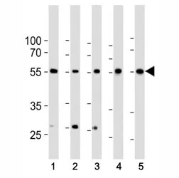 BMPR1A Antibody (ALK3) - image 1