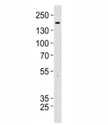TSC2 Antibody - image 1