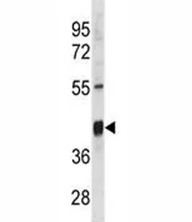 Txnip Antibody - image 1