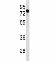 GATAD2A Antibody (p66 alpha) - image 1