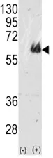 TAU Antibody (MAPT) - image 1