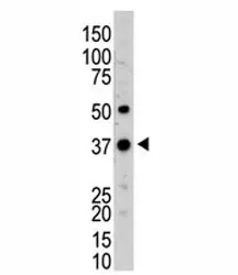 UCH37 Antibody (UCHL5) - image 1
