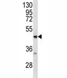 RAGE Antibody - image 1