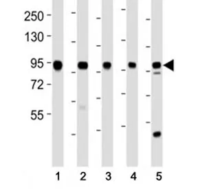 EZH2 Antibody - image 1