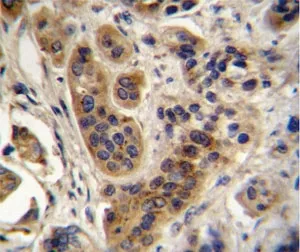 ACOX1 Antibody / Peroxisomal acyl-coenzyme A oxidase 1 - image 1
