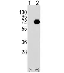 ACOX1 Antibody / Peroxisomal acyl-coenzyme A oxidase 1 - image 1