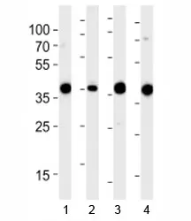 Aldolase Antibody - image 1