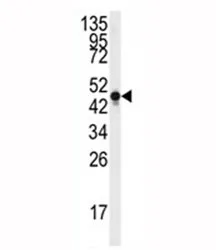 Neuron Specific Enolase Antibody - image 1