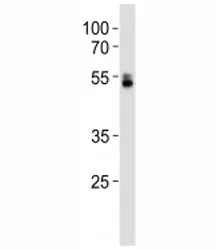 RUNX1 Antibody - image 1