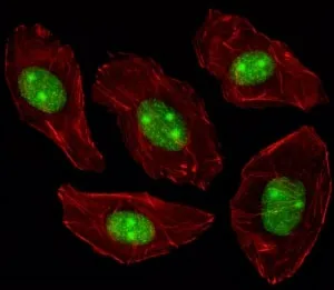 Nucleophosmin Antibody (Npm1) - image 1