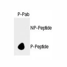 Retinoblastoma / Rb Antibody (phospho-S788) - image 1