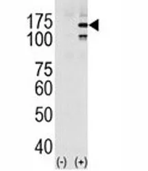EGFR Antibody (phospho-Y1069) - image 1