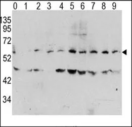 Phospho c-Myc Antibody (pT58) - image 1