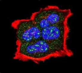 TSC2 Antibody (phospho-S1420) - image 1