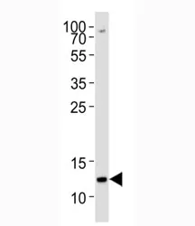 Histone H4 Antibody (Methyl-Lys20 specific) - image 1