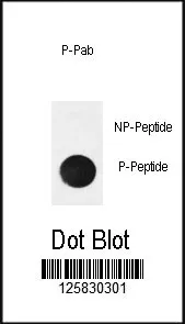 Phospho-IkBa Antibody (pSer32)) - image 1
