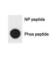 p62 Antibody SQSTM1 (phospho-S403) - image 1