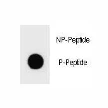 TSC2 Antibody (phospho-S1096) - image 1