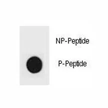 TSC2 Antibody (phospho-S1096) - image 1